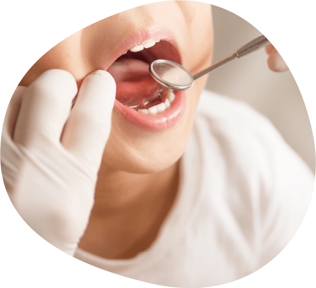 乳歯の虫歯は適切な治療を心がけています